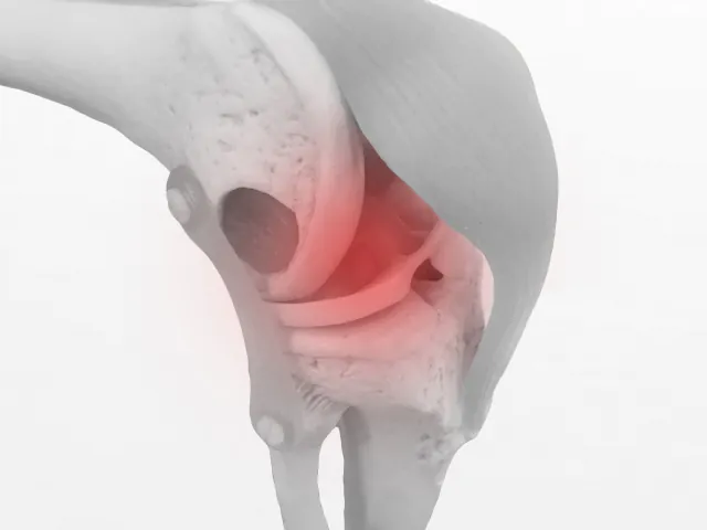 人工膝関節置換術とは