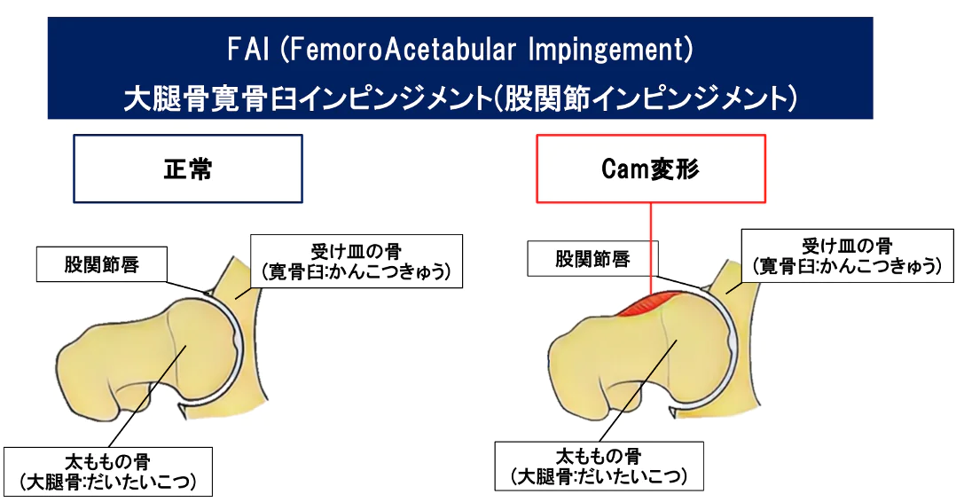 FAI