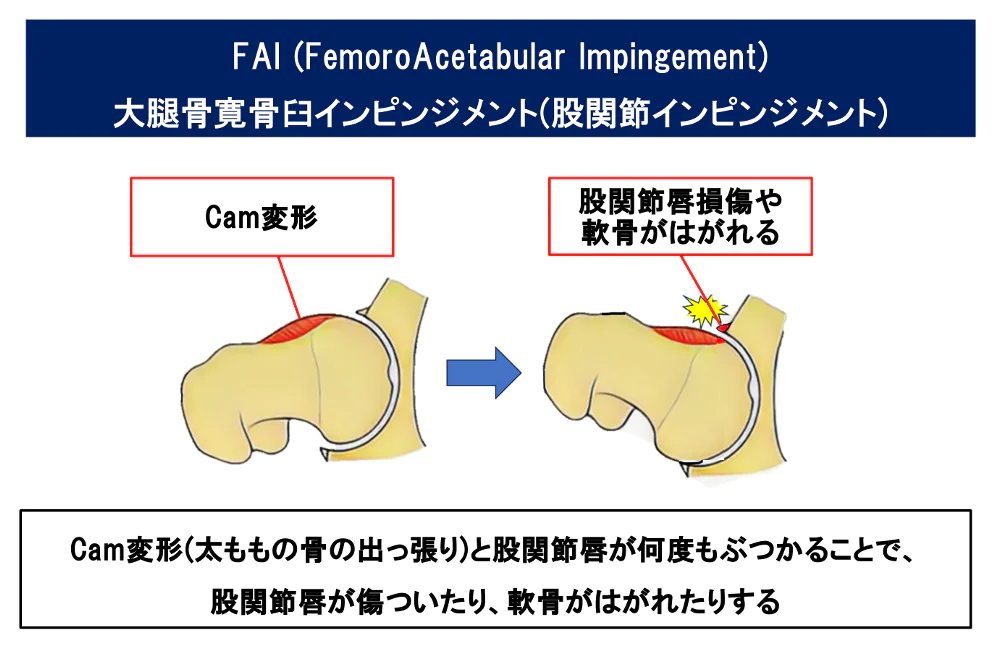 FAI