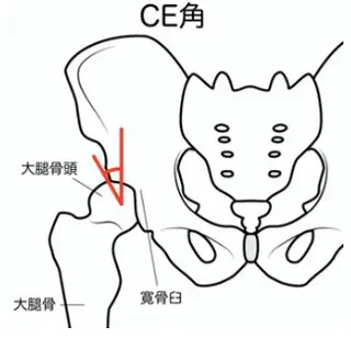 CE角