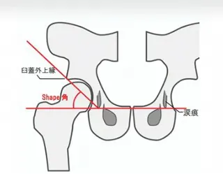Sharp角
