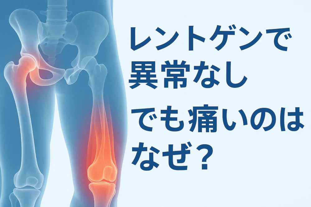 レントゲンで「異常なし」と言われたのに膝や股関節が痛いのはなぜ？
